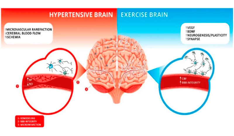 La hipertensión y el cerebro